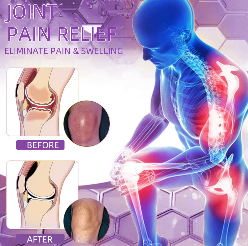 𝐎𝐟𝐟𝐢𝐜𝐢𝐚𝐥 𝐒𝐭𝐨𝐫𝐞: 𝐓𝐋𝐎𝐏𝐀® 𝑺𝒉𝒂𝒓𝒌 𝑪𝒂𝒓𝒕𝒊𝒍𝒂𝒈𝒆 𝑷𝒂𝒊𝒏-𝑺𝒐𝒐𝒕𝒉𝒊𝒏𝒈 𝑩𝒐𝒏𝒆 𝑹𝒆𝒄𝒐𝒗𝒆𝒓𝒚 𝑮𝒆𝒍