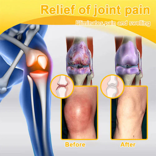 Trilumia® Botulinum Toxin & Bee Venom Pain-Relief Bone Healing Cream🌟