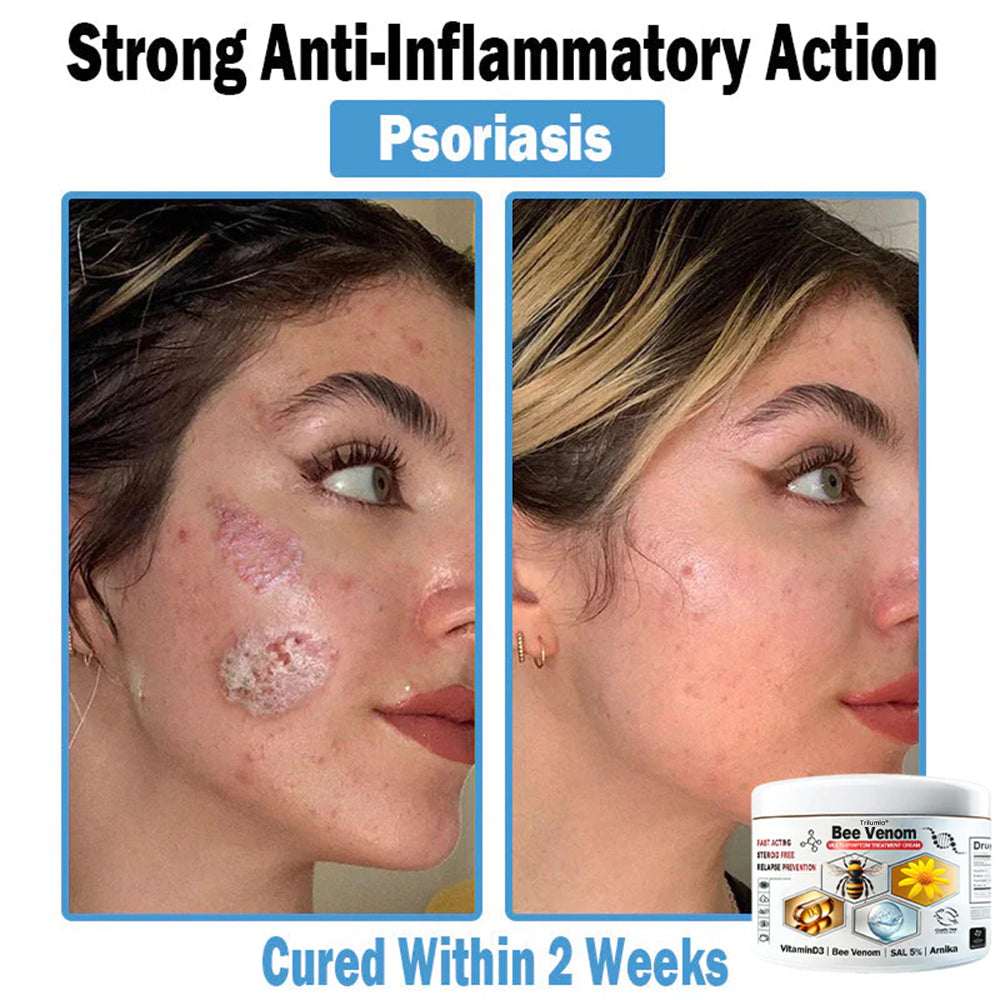 Trilumia® Bee Venom Multi-Symptom Skin Treatment Cream (👨‍⚕BAD RECOMMENDS)