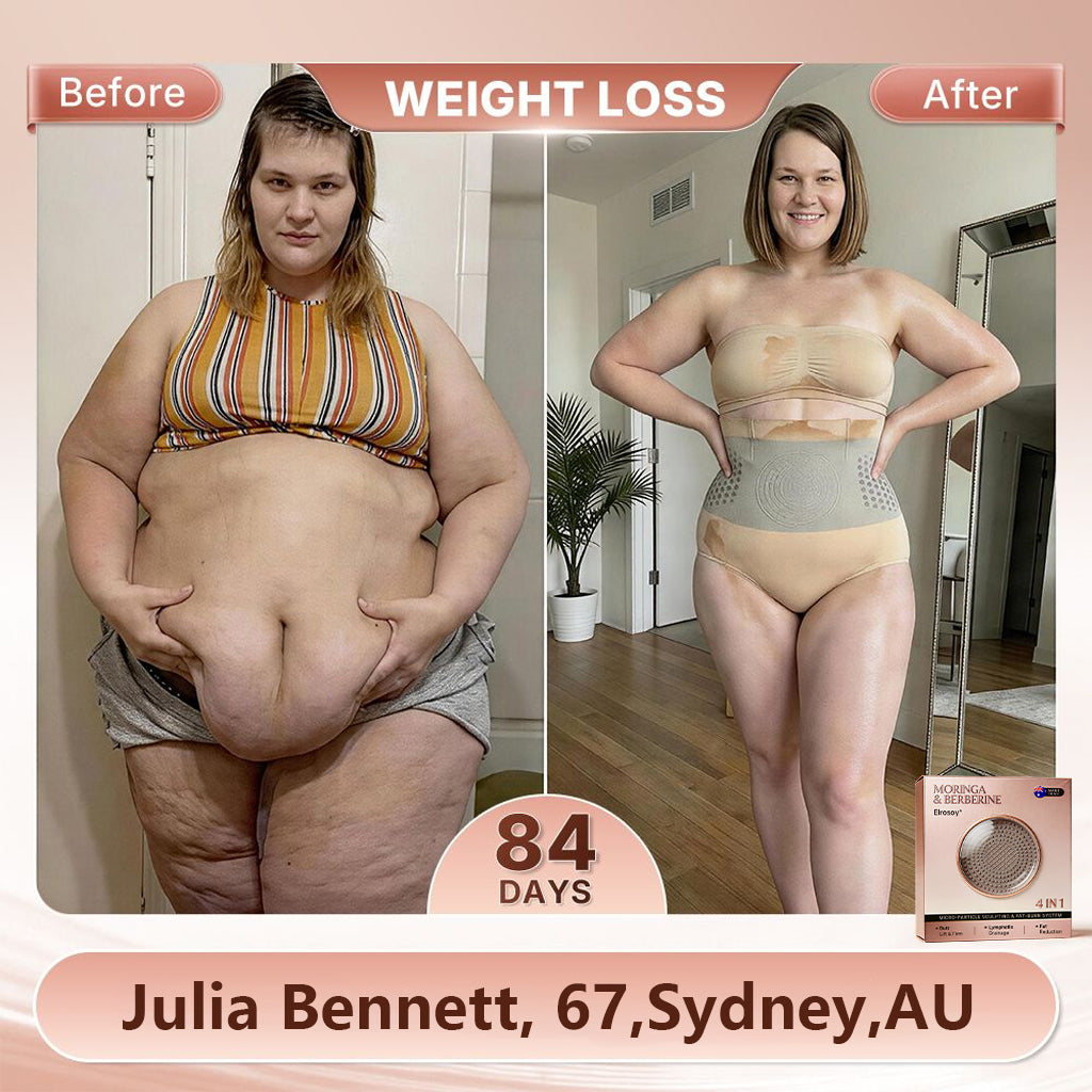 𝐄𝐥𝐫о𝐬𝐨𝐲®🛵𝐌𝐨𝐫𝐢𝐧𝐠𝐚 & 𝐁𝐞𝐫𝐛𝐞𝐫𝐢𝐧𝐞 4-𝐈𝐧-1 𝐌𝐢𝐜𝐫𝐨-𝐏𝐚𝐫𝐭𝐢𝐜𝐥𝐞 𝐒𝐜𝐮𝐥𝐩𝐭𝐢𝐧𝐠 & 𝐅𝐚𝐭-𝐁𝐮𝐫𝐧 𝐒𝐡𝐨𝐫𝐭𝐬🌊